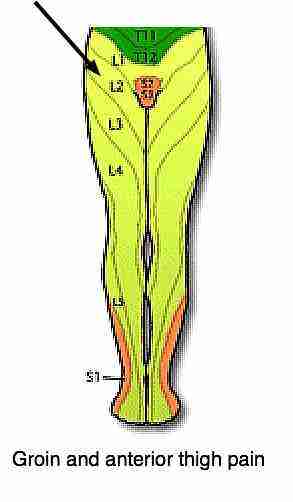 Femoral nerve casefile has severe pain in the front of the thigh.