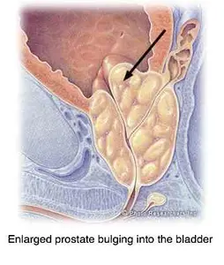 Prostate gland health