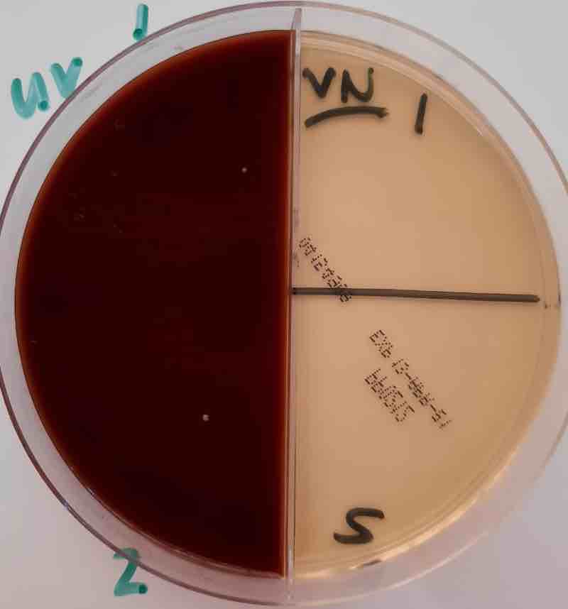 Bacteria in rainwater.