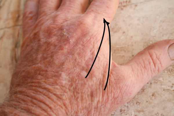 Dorsal interosseous pinch muscles Dorsal interosseous pinch muscles