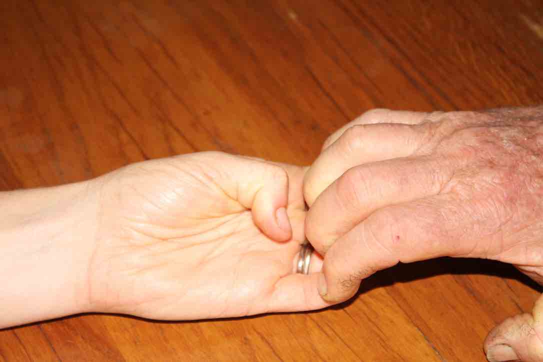 Does the thumb adduct in the impending stroke test? Does the thumb adduct in the impending stroke test?