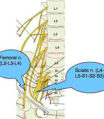 Femoral nerve casefile has severe pain in the front of the thigh.