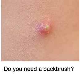 Of pimples and back-brushes. Of pimples and back-brushes.
