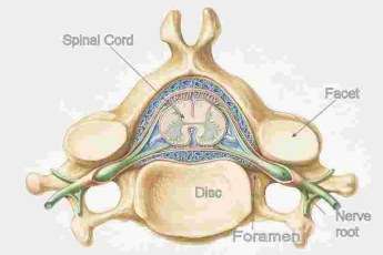 The sensory and motor fibres join forming a mixed spinal nerve in the foramen The sensory and motor fibres join forming a mixed spinal nerve in the foramen