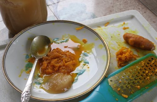 Turmeric and raw honey treatment for bedsores Turmeric and raw honey treatment for bedsores