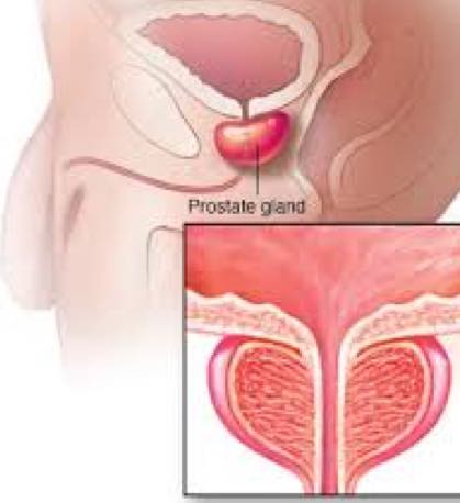 Prostate gland and vitamin E. Prostate gland and vitamin E.